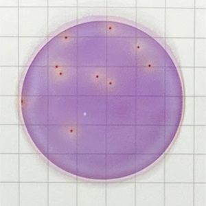 Placas de recuento rápido para Enterobacteriaceae (EB)